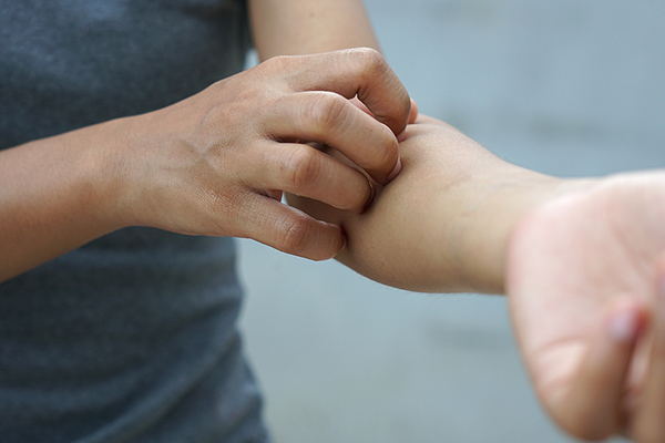 Person scratching arm from food allergy